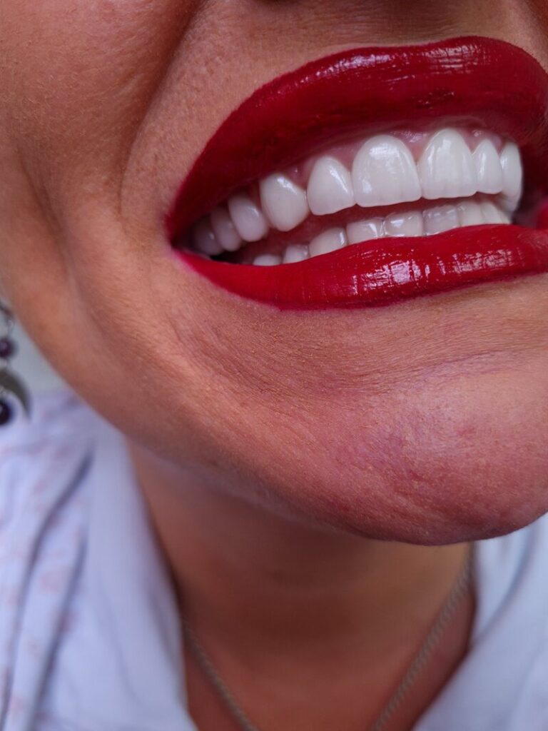 Hollywood smile zubna ordinacija krusevac