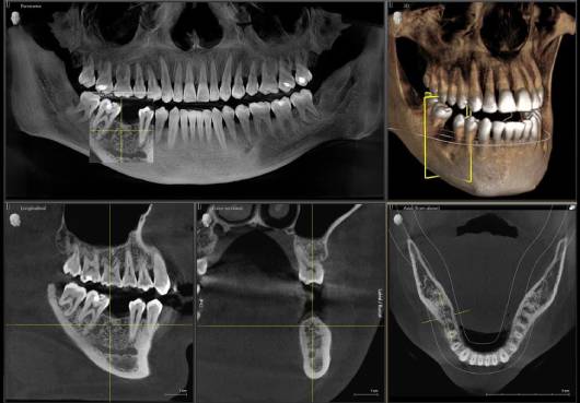 Oralna hirurgija Kruševac Dental Home