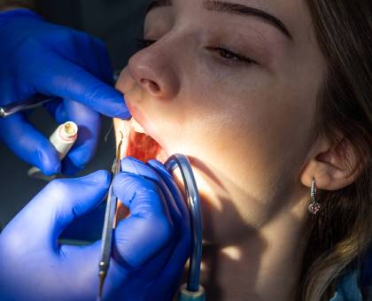 Popravka i lečenje zuba Krusevac Stomatoloska ordinacija Dental home